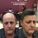 Peruca Masculina Ultra Realista - HairPro™ [PROMOÇÃO LIMITADA ATÉ HOJE 23:59]